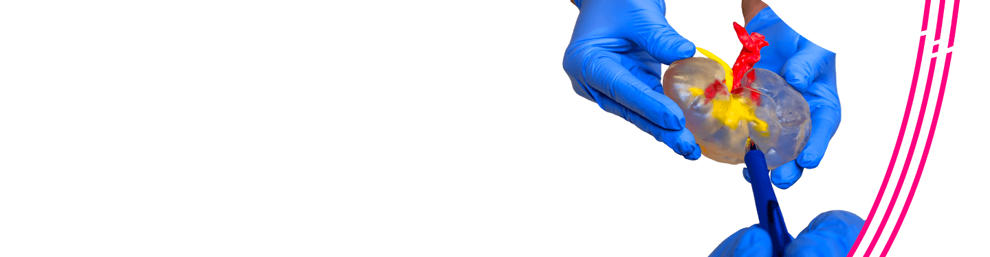 3D printed anatomy being held by hands with blue surgical gloves, one side has a pen pointing to the 3D model