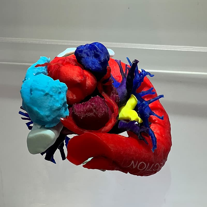 3D printed heart